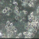 20. Konzultacije uz Darkfield analizu